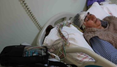 Diyarbakır’da epilepsi hastalarına video EEG sistemi ile tanı konuluyor