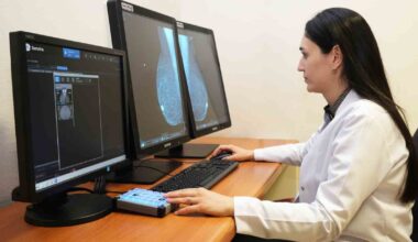 Meme kanseri tanısında yeni teknoloji 3D tomosentez mamografi cihazı SANKO’da