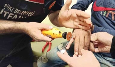 Siirt’te bir gencin parmağına sıkışan yüzük itfaiye ekiplerince çıkarıldı