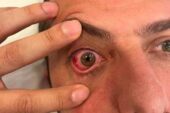 Eyüpspor: “Uğur Demirok’un gözünden ameliyat olma ihtimali bulunuyor”